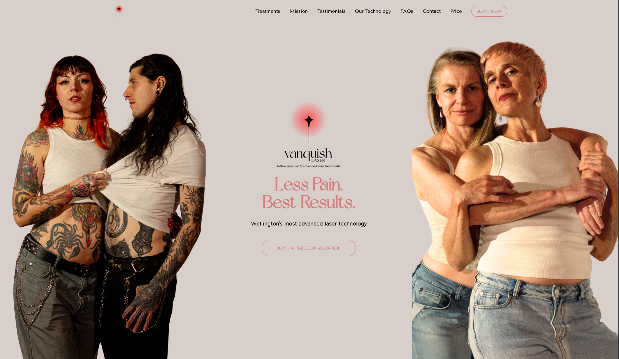 Vanquish Laser website screenshot